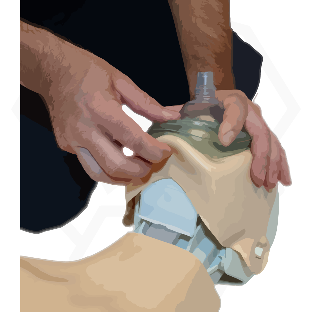 Dispositivo de protección para reanimación cardiopulmonar