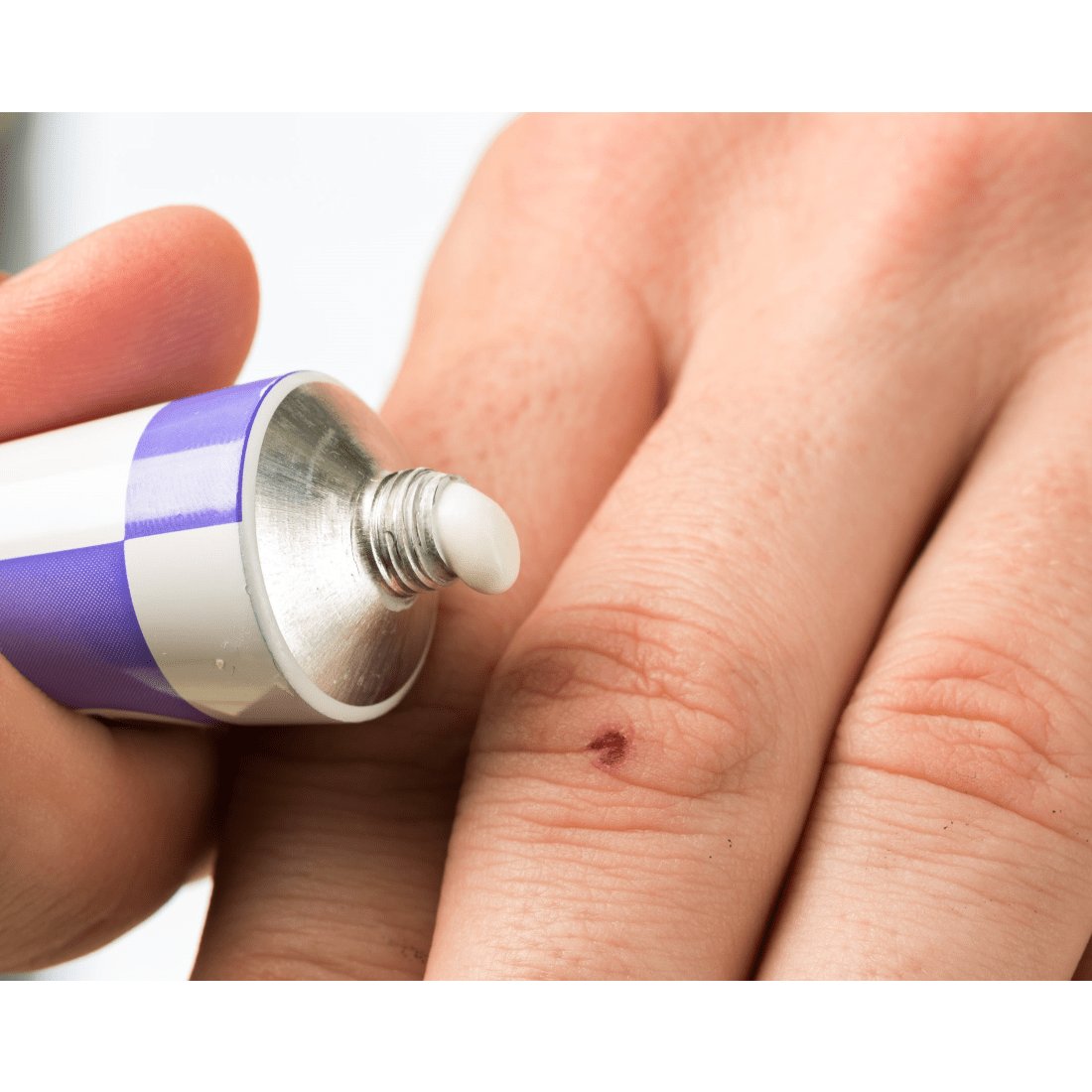 Antibiotic ointment, topical, single-use