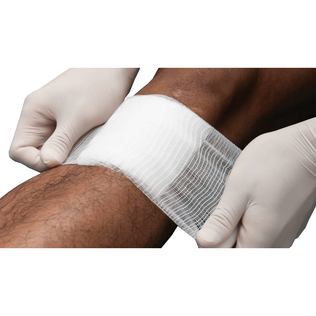 Compresses/pressure dressings with ties, sterile, 10.2 cm x 10.2 cm (4 in. x 4 in.)