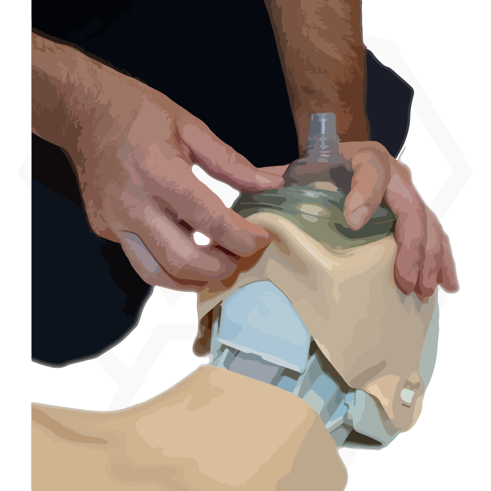 Cardiopulmonary resuscitation (CPR) barrier device with unidirectional valve